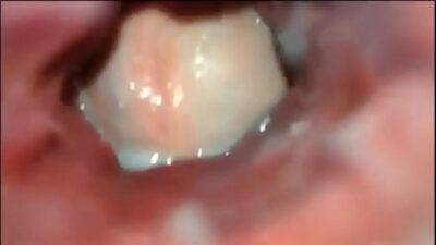 Anal Inside View